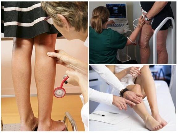 Diagnostic des varices