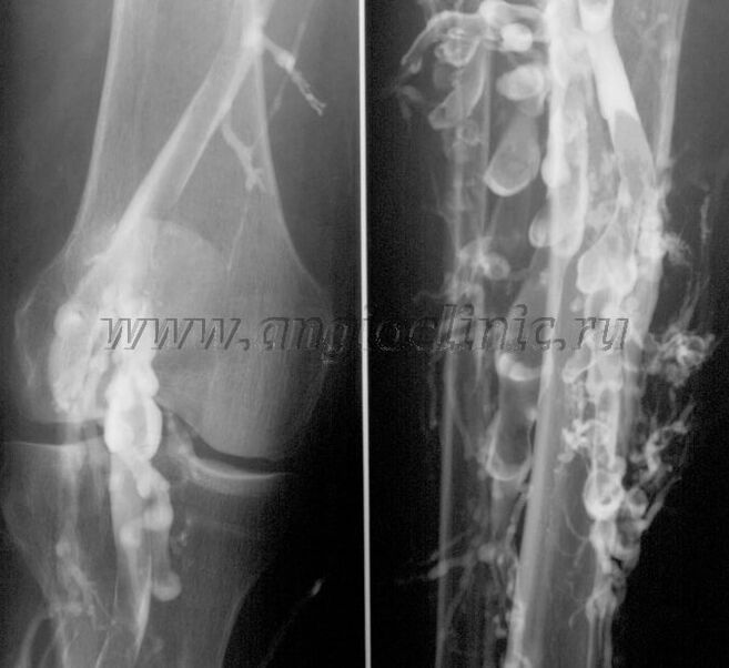 Examen échographique